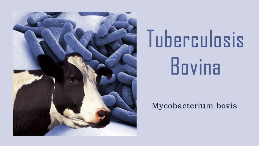 Tuberculosis Bovina